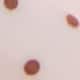 Pink Black Spot